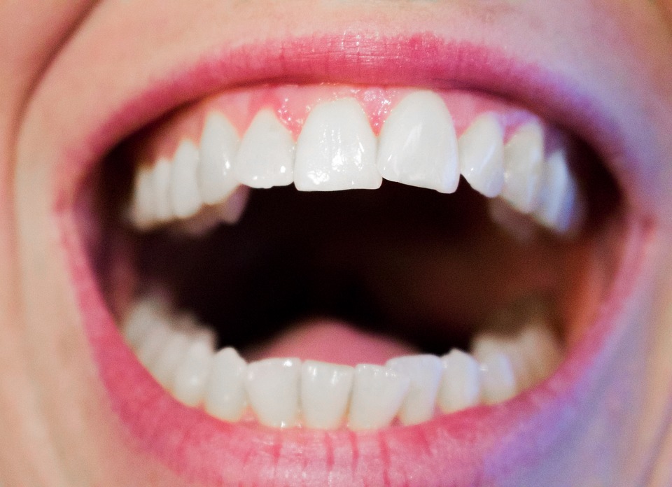 Heart Disease: What Your Teeth May Tell You About Your Heart