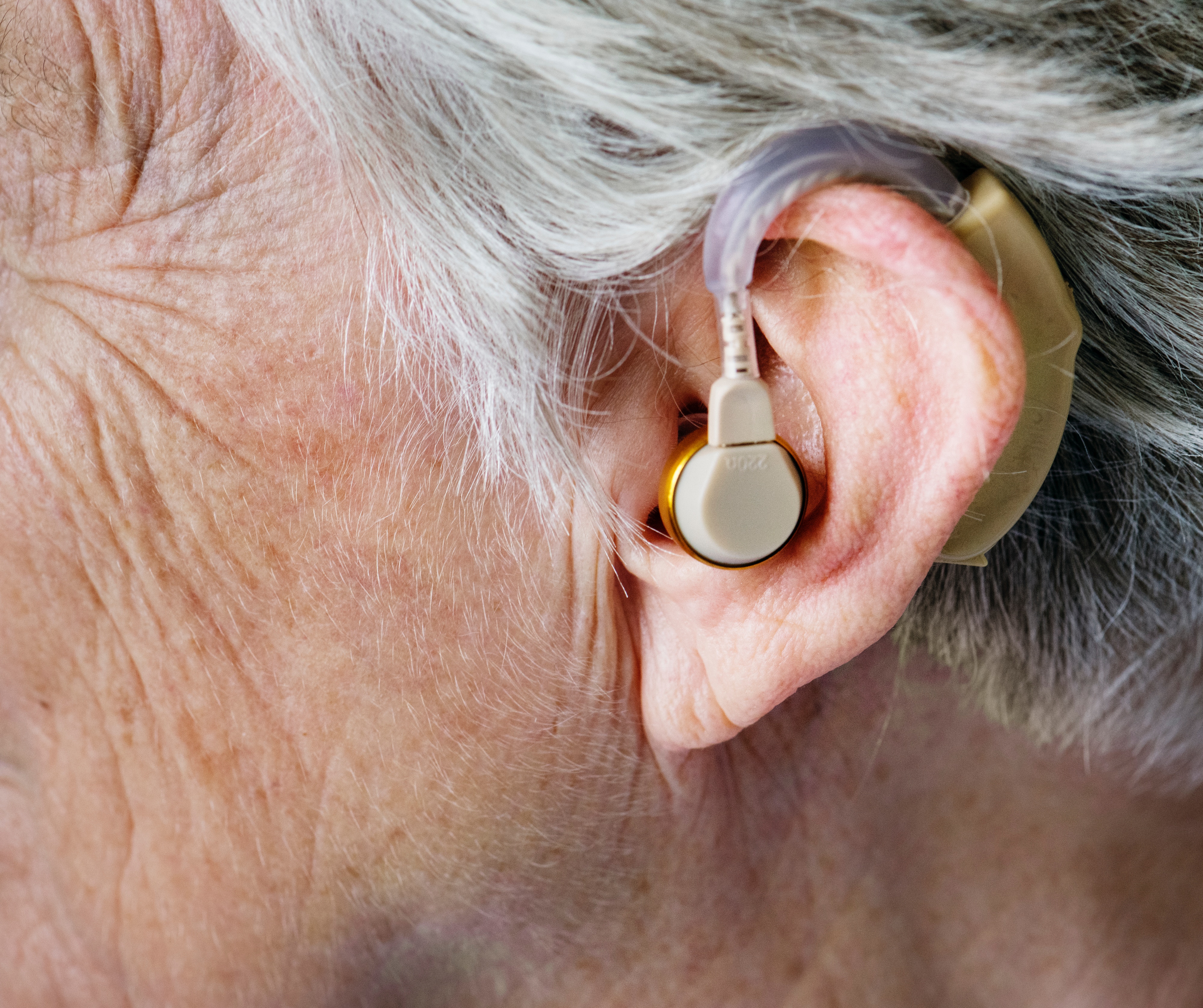 hearing loss in the elderly